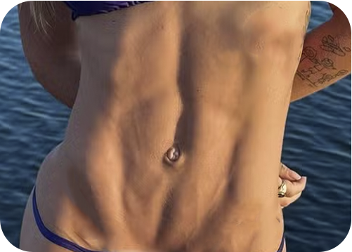 Lipo LAD
